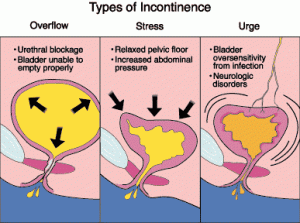 Incontinence Treatment